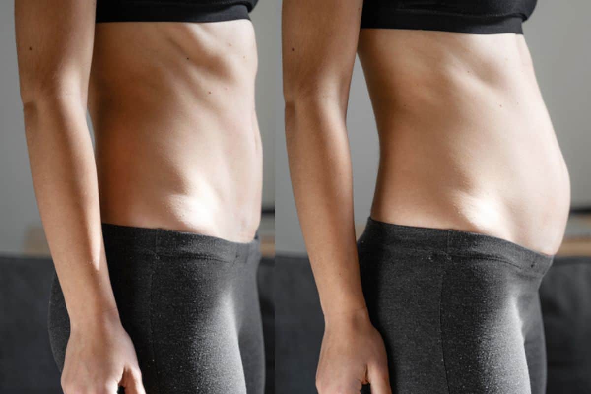 How long does diastasis recti take to improve Great Yarmouth?