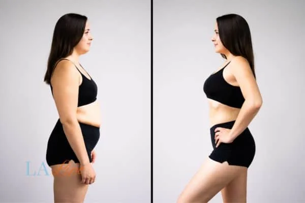 link between body image and mental health Great Yarmouth