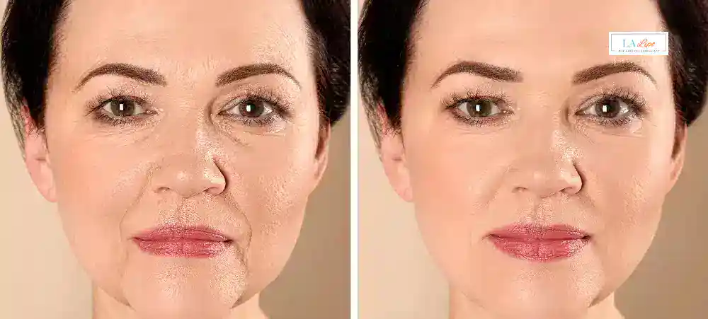 Why Aren’t My Skincare Products Making My Sagging Skin Look Firmer Great Yarmouth?